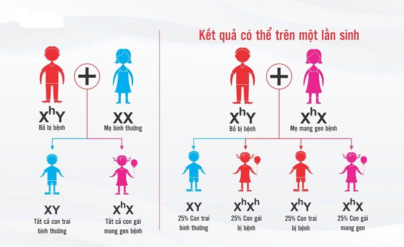 Hemophilia được di truyền lặn liên kết X